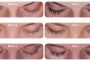 Enhancing Your Eyelashes with Latisse