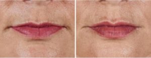 volbella-768x299 volbella-768x299
